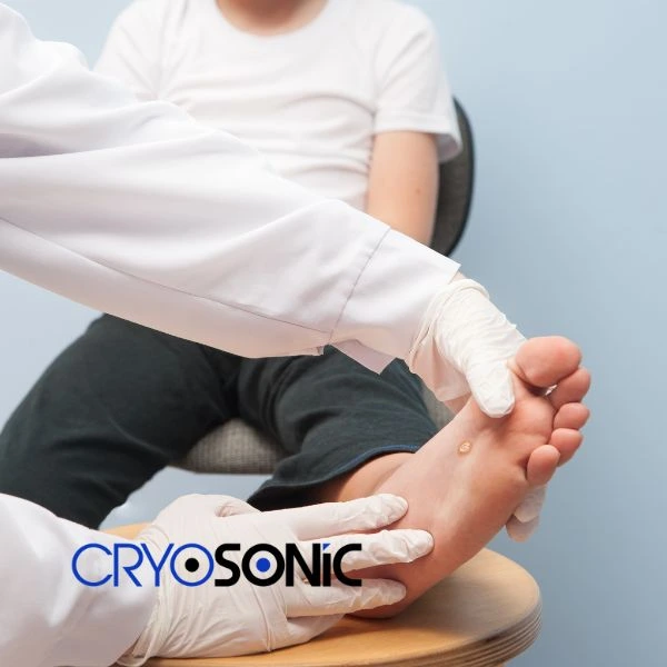 Are you looking for fast effective wart removal Contact us today Croydon