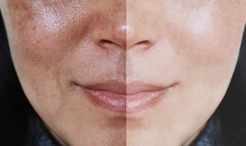 What Lifestyle Changes Support Skin Repair Croydon? Croydon